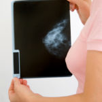 3D Mammography Phoenix, AZ