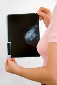 3D Mammography  Phoenix, AZ 